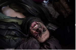 Injured Soldier while he is being stabilized in Bakhmut